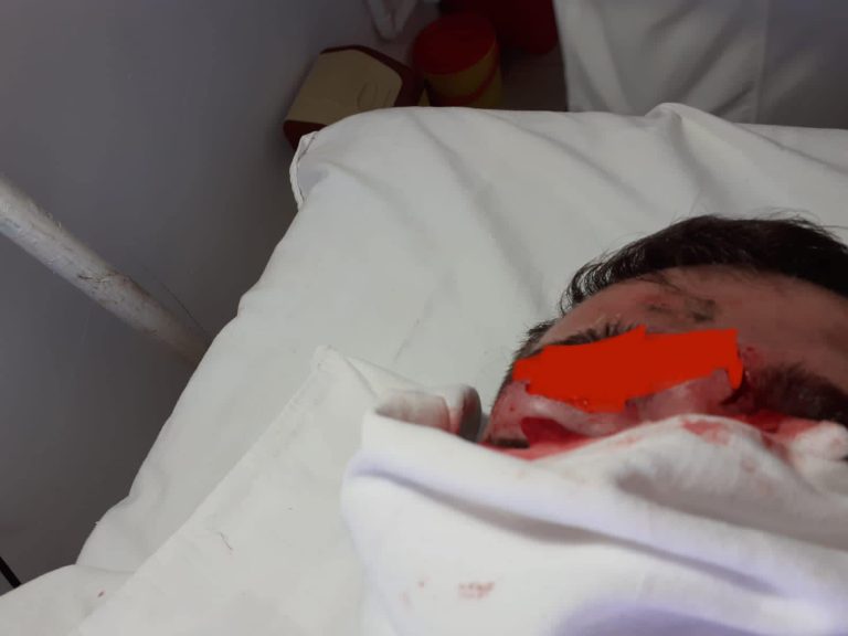Dëmtimi i portjerit Vata, KF Tërbuni publikon fotot e rënda. Akuza për arbitrin që nuk e ndëshkoi as me karton të verdhë lojtarin kundërshtar!